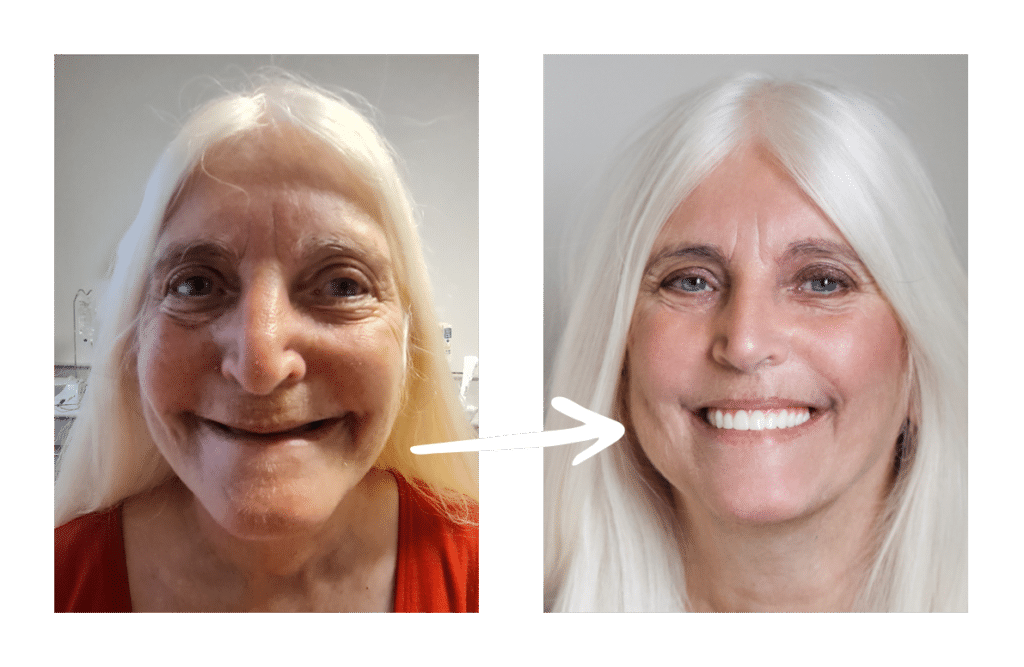 before-after-smiles-cv-4-1024x667