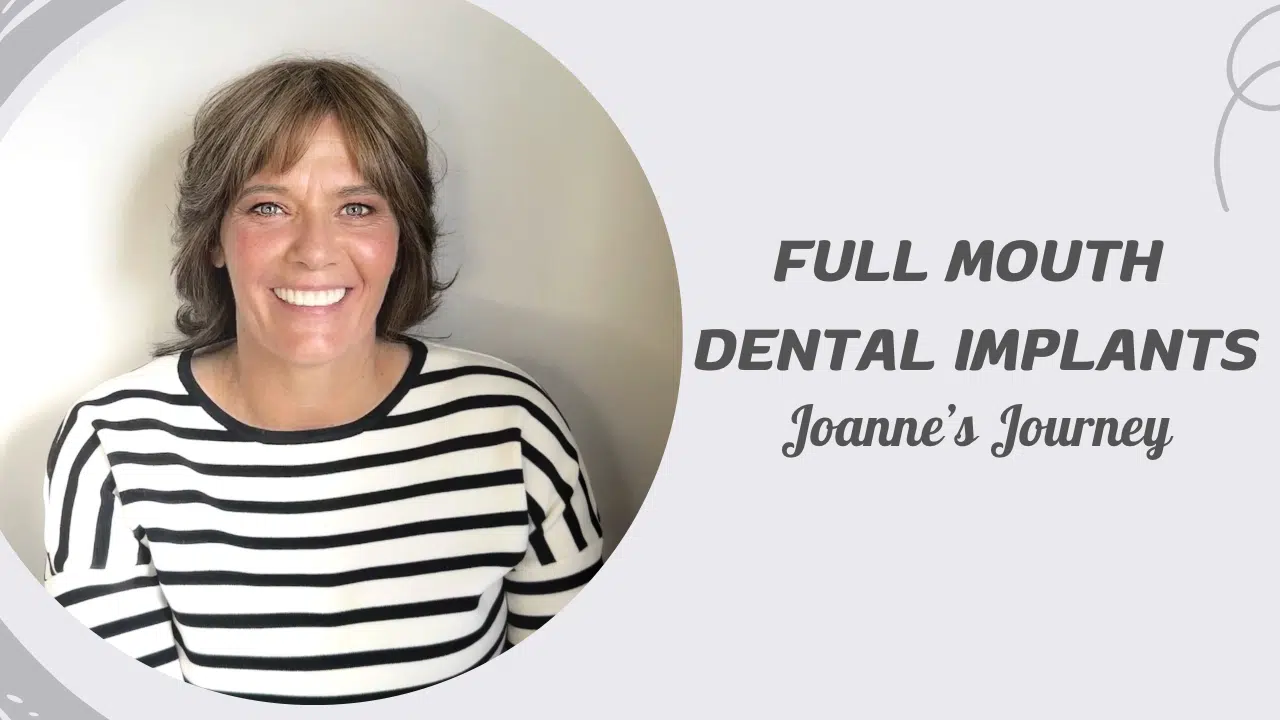 Full mouth dental implants- Joanne's Journey