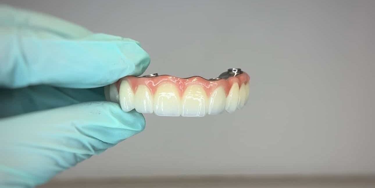 All-on-4 implant bridge. Zirconia