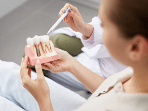 Dental Implant Services