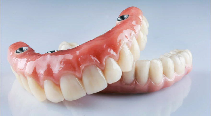 Dental implant bridges All-on-4