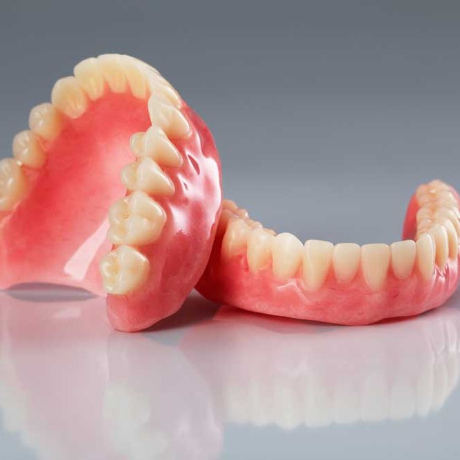 Benefits of Dental Implants Compared to Dentures