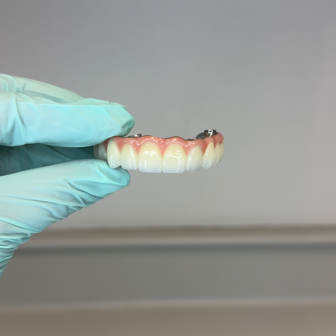 What factors affect the cost of dental implants?