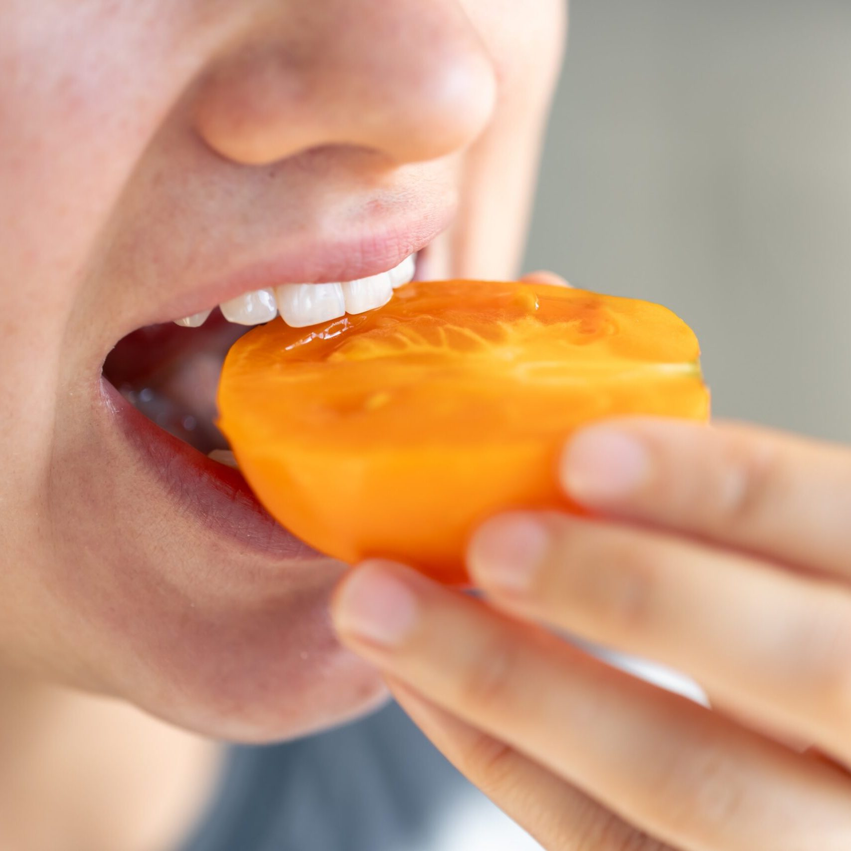 Benefits of Dental Implants